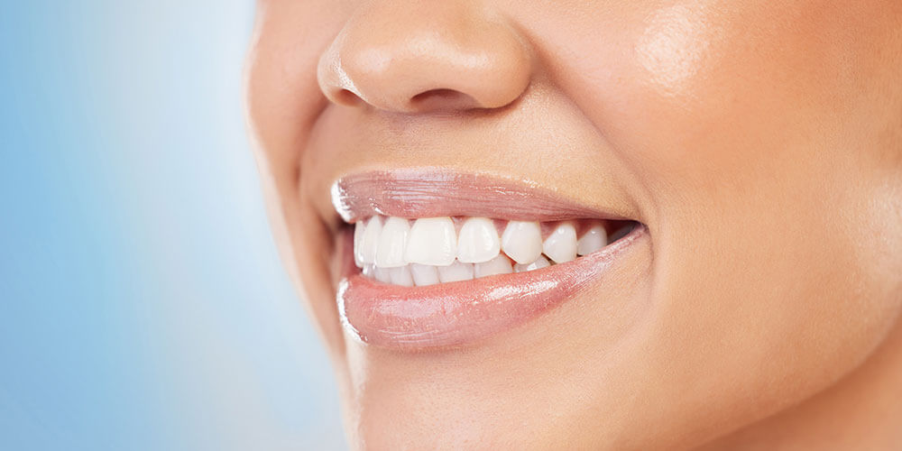 Fluoride Treatment Cornwall
