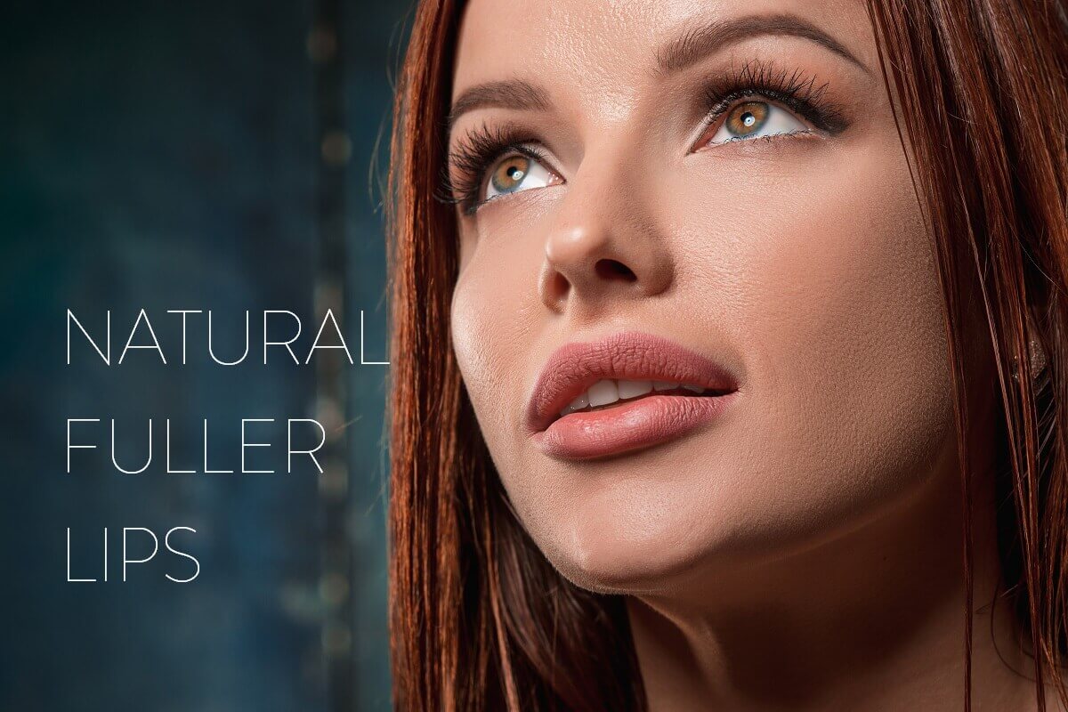 Lip Fillers Cornwall