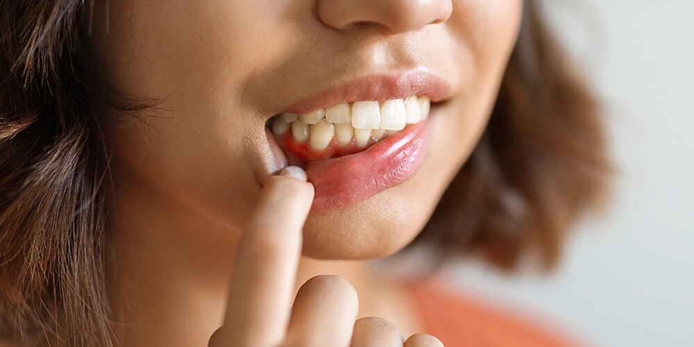 Periodontal Therapy Cornwall